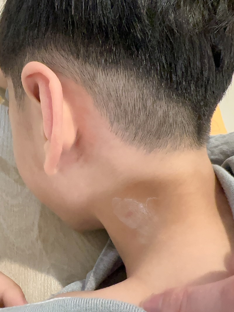 女人知己試用大隊,口碑行銷,部落客行銷,Proctoeze Cream普治緩保護軟膏,軟膏,皮膚護理,傷口照護,不含類固醇,草本成分,止癢,搔癢,傷口,止痛,疼痛,嬰兒紅臀,尿道搔癢/疼痛,更年期會陰搔癢/疼痛,男性/女性/老年人/ 嬰幼兒私密處,肛門,皮膚,臀部,歐洲進口原料,敏感肌,異位性皮膚炎,更年期會陰症狀,多家醫學中心/知名婦產/痔瘡專科診所指定使用解決肌膚不適問題是效果及安全性的最佳保證,全家適用